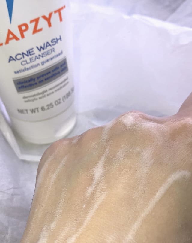 ZAPZYT Acne Wash review photo by Picky05028
