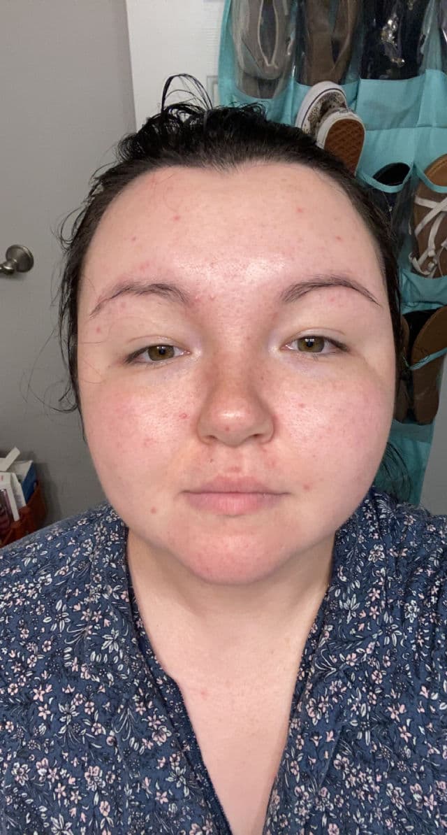 First Aid Beauty Gentle Foaming Cleanser with Amino Acids review photo by Picky161473