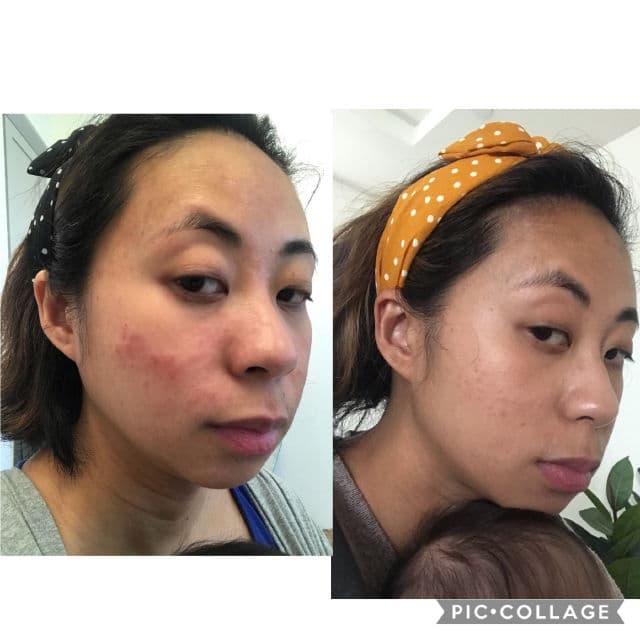 Good Molecules Discoloration Correcting Serum review photo by Picky67134