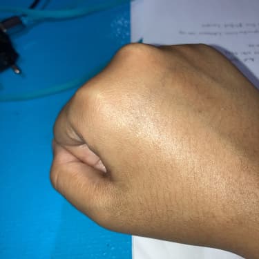 The Ordinary 100% Organic Cold-Pressed Rose Hip Seed Oil review photo by AiniMentari