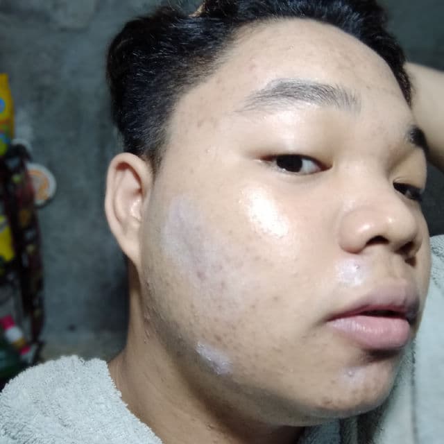 Dr. S. Wong's Bioderm Ointment review photo by skincarewithian