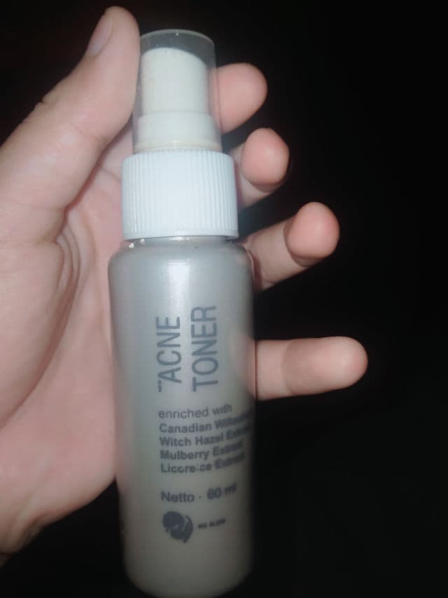 Ms Glow Acne Toner review photo by Renatyaswati