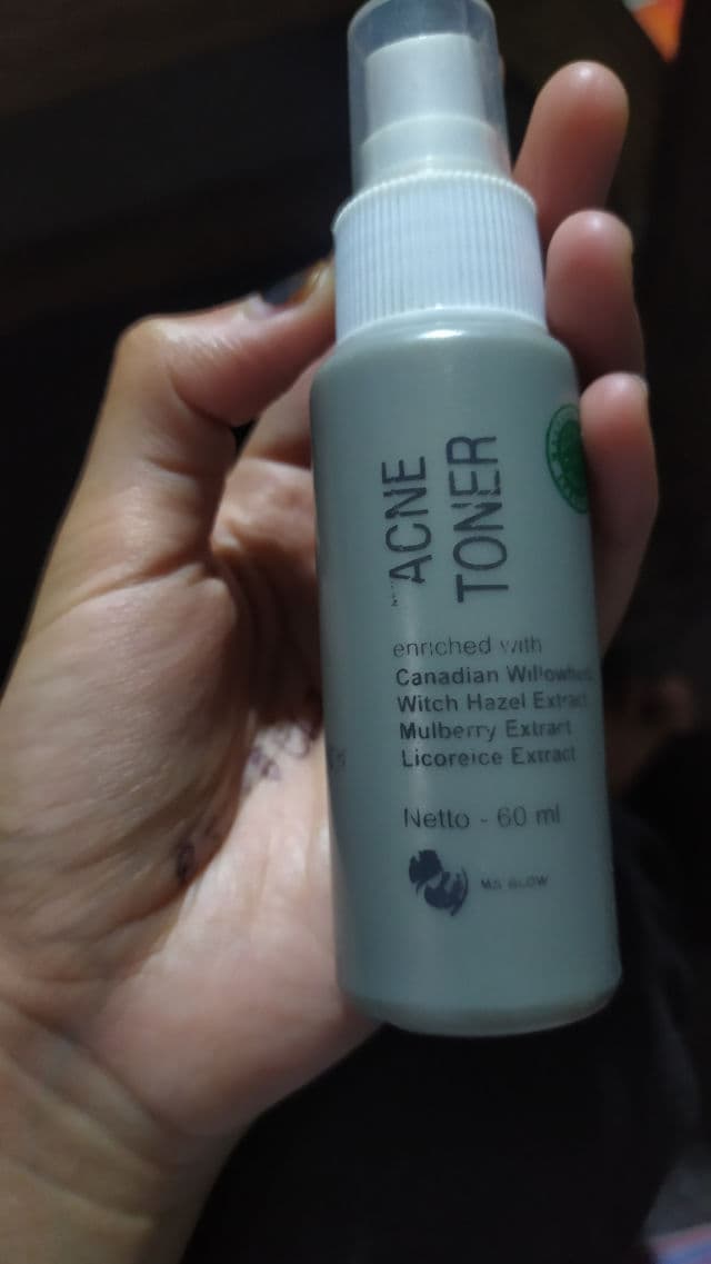 Ms Glow Acne Toner review photo by Rzkiwll
