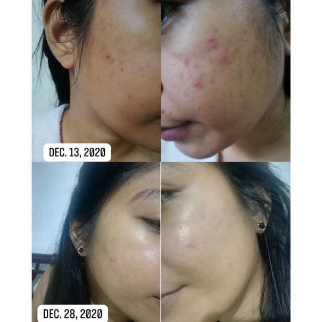 Derma Natufian Niacinamide Serum review photo by Sashimi