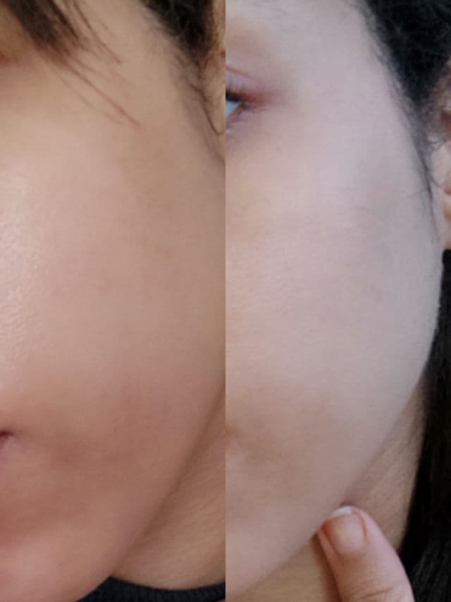 facetheory Regenacalm 2% Retinol and Vitamin C Serum review photo by Shanae