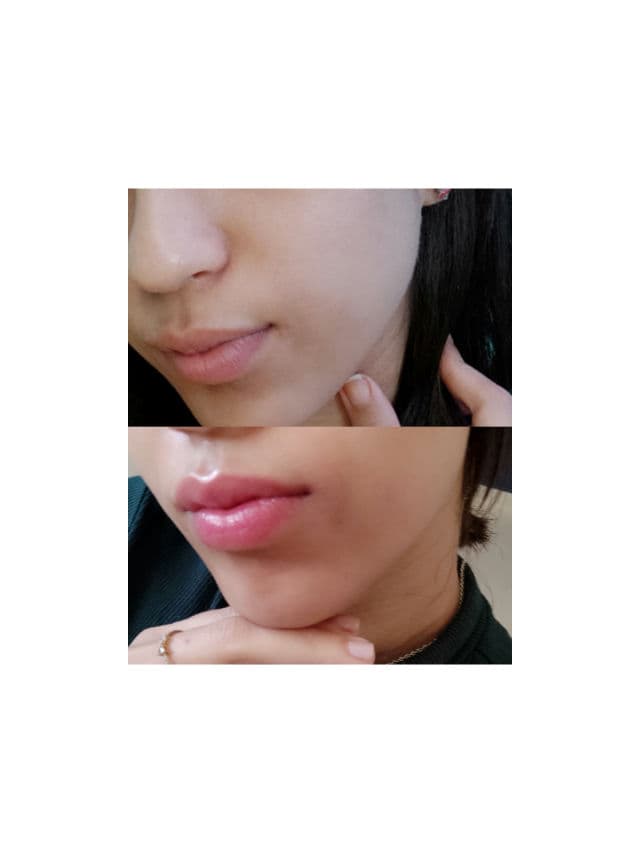 facetheory Regenacalm 2% Retinol and Vitamin C Serum review photo by Shanae