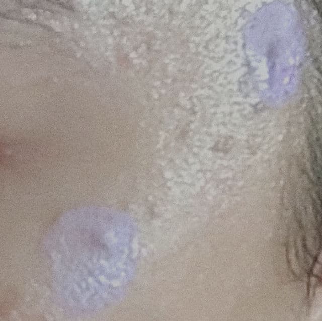 Daughters of Malaya Sulfur Spot Drying Lotion review photo by Skinbyrd