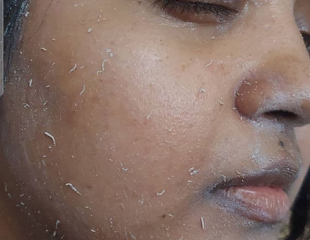 FixDerma Shadow SPF 80+ Sunscreen Lotion review photo by Tapaswini