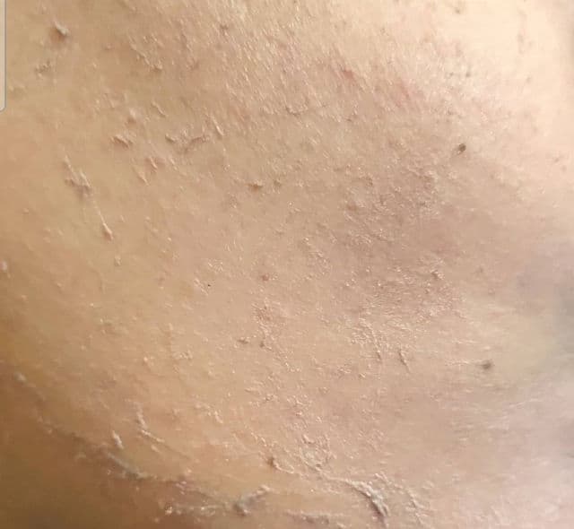 Re'equil Sheer Zinc Tinted Mineral Sunscreen SPF 50 PA review photo by Tapaswini