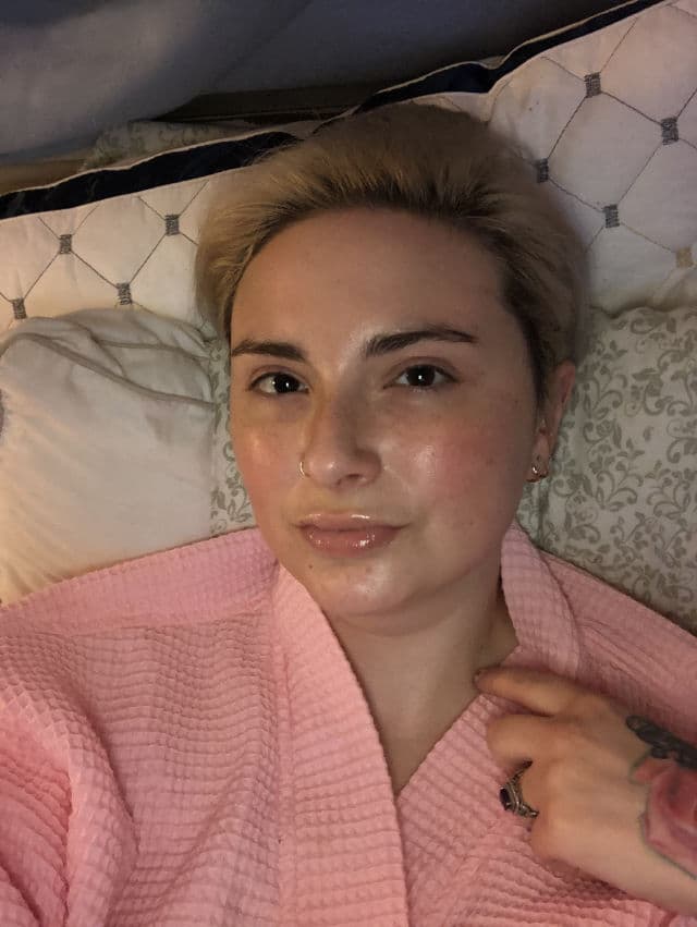 Johnson's Tretinoin Retino-A 0.025% Cream review photo by ThisEerieSkin