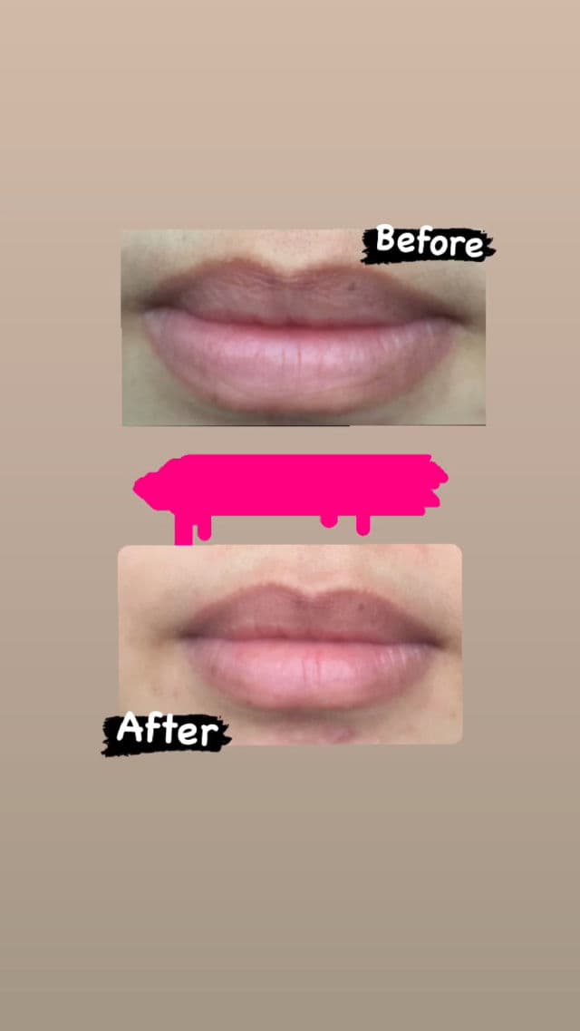 Unpa Bubi Bubi Lip Mask  review photo by Vivianie