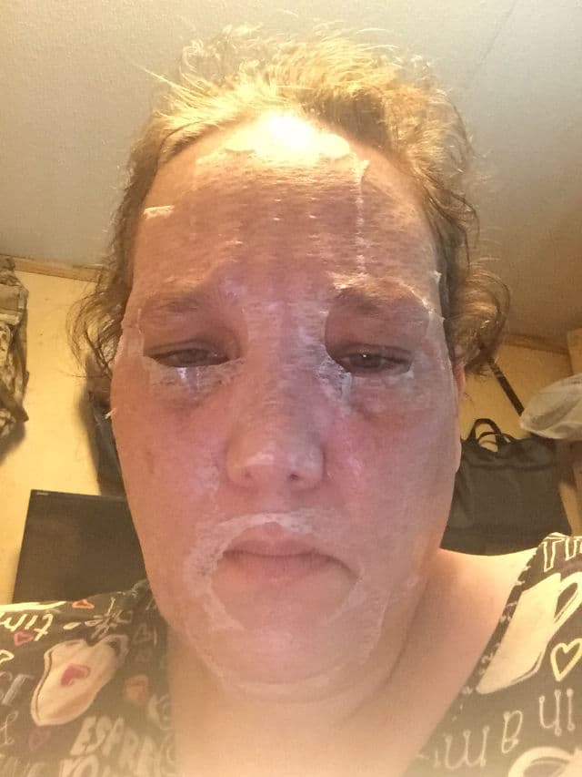 Masqueology Collagen Melting Web Mask - Step 2 Mask review photo by Tinaturner