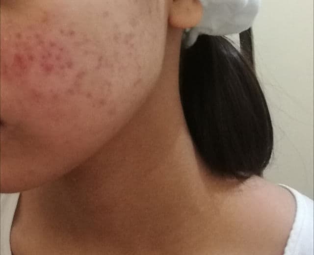 Cetaphil Gentle Cleansing Antibacterial Bar review photo by PhoeminineUnnie