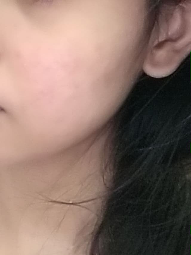 Cetaphil Gentle Cleansing Antibacterial Bar review photo by PhoeminineUnnie