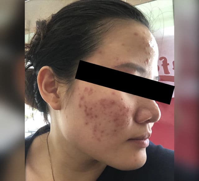 Dr. Wu Intensive Renewal Serum With Mandelic Acid 18% review photo by Winkie