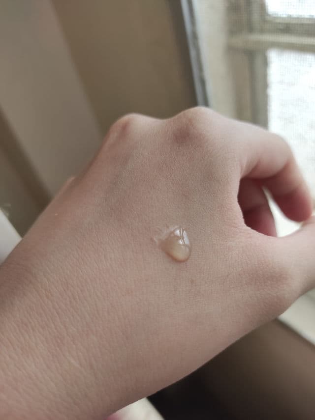 Lanbena TCM Scar and Acne Mark Removal Gel Ointment review photo by Zenister