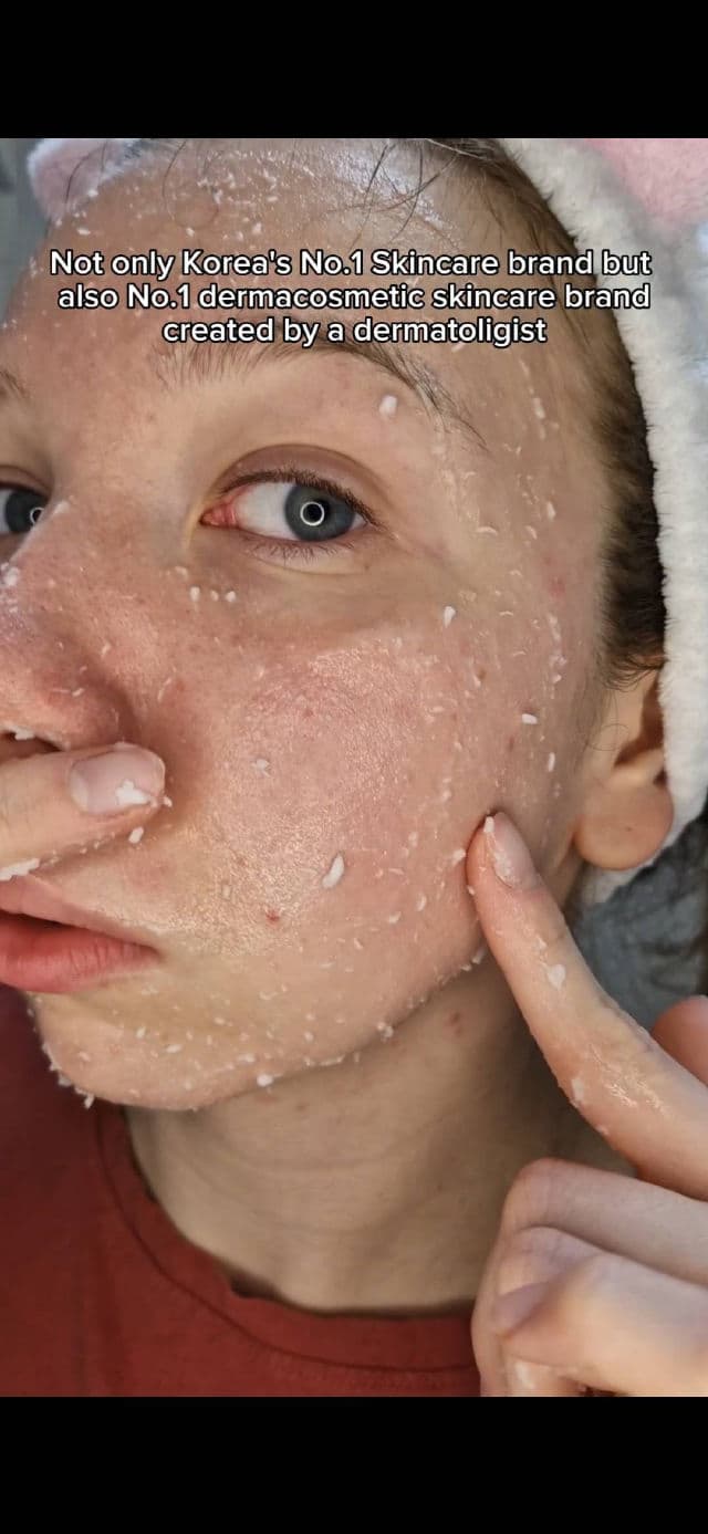 DR.G Brightening Peeling Gel review photo by Malinkova