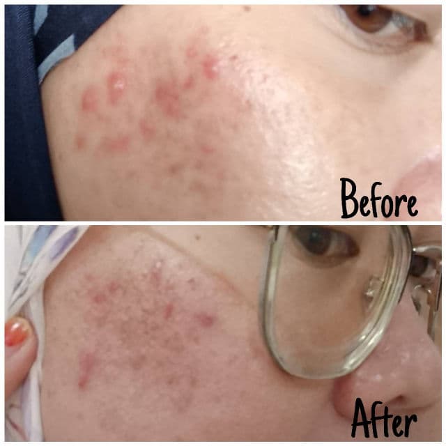 Dear, Klairs Supple Preparation Unscented Toner review photo by Jamalia