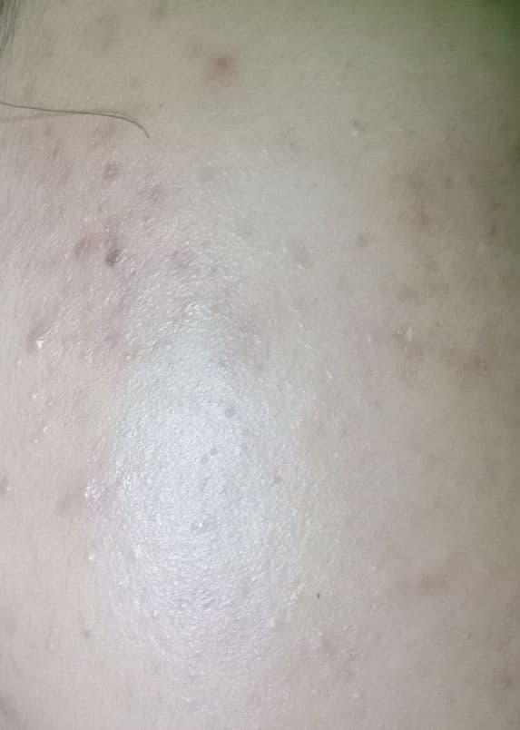 COSRX AHA/BHA Clarifying Treatment Toner review photo by Sitiaidahussin