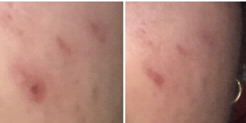 Apotheke Science Niacinamide 5% review photo by alysaa