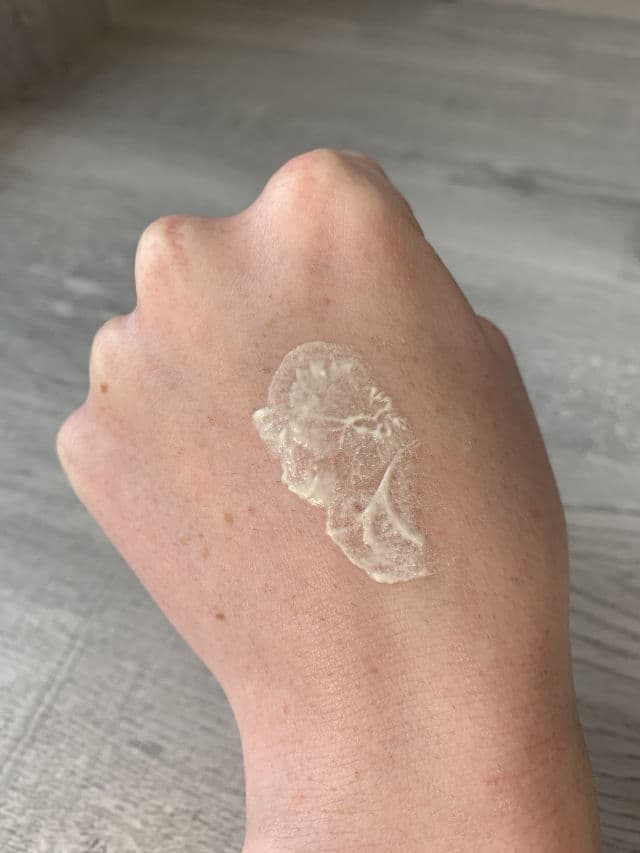 Versed Game Over Acne Drying Treatment review photo by alyssalynnskin