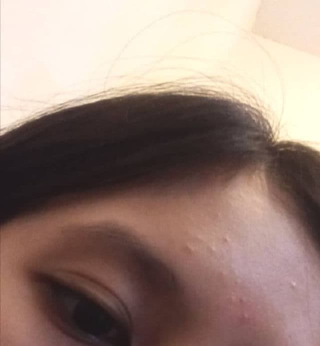 The Ordinary Niacinamide 10% + Zinc 1% review photo by ashleyyyy