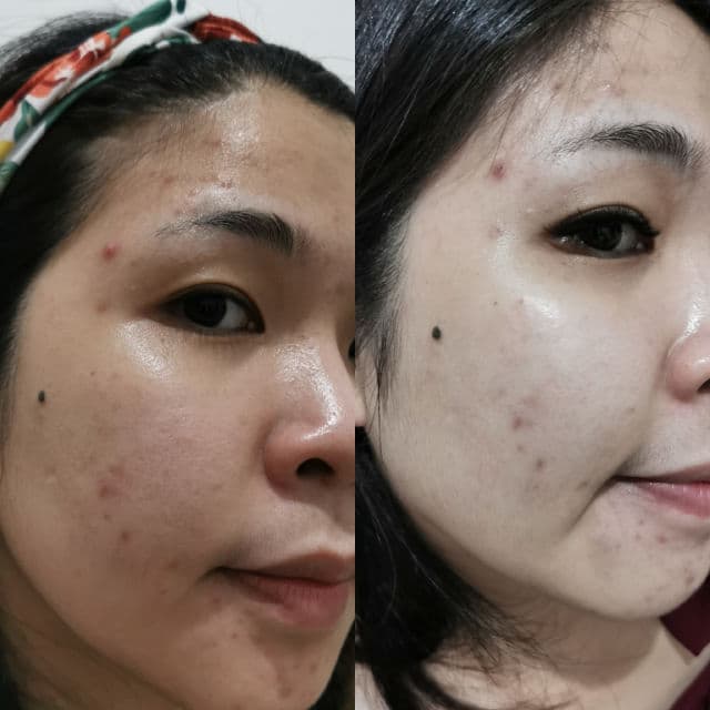 Zlota Glow Serum review photo by anaztasiapw