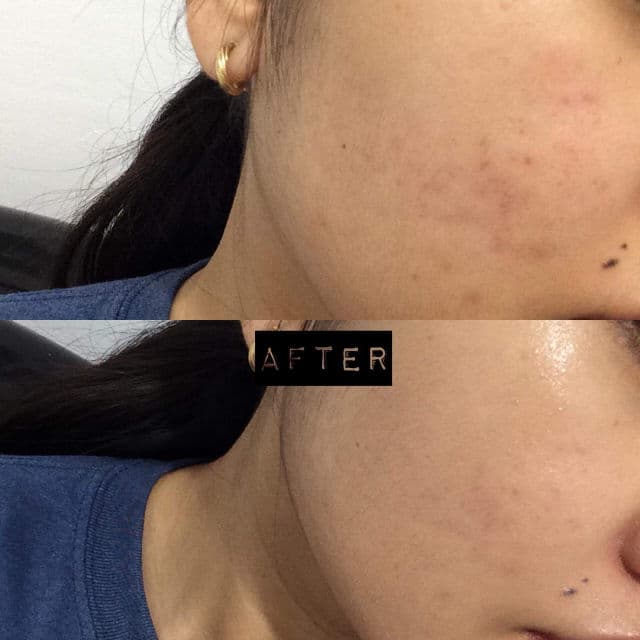 iWhite Korea Light review photo by angegege