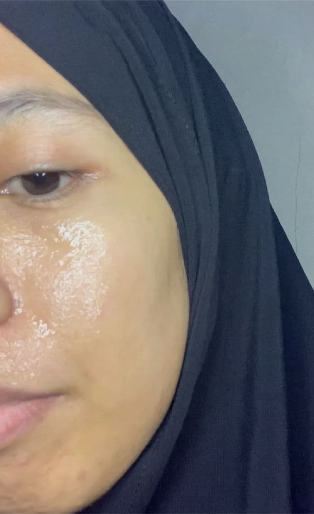 Nadfaskin Hyaluronic Acid Serum review photo by aprianiamr