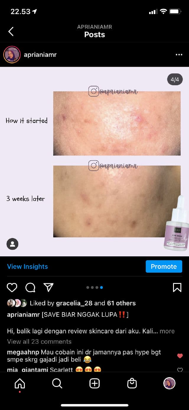 Scarlett Whitening Acne Serum review photo by aprianiamr