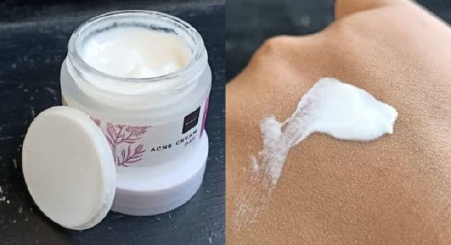 Scarlett Whitening Acne Day Cream review photo by fiasday