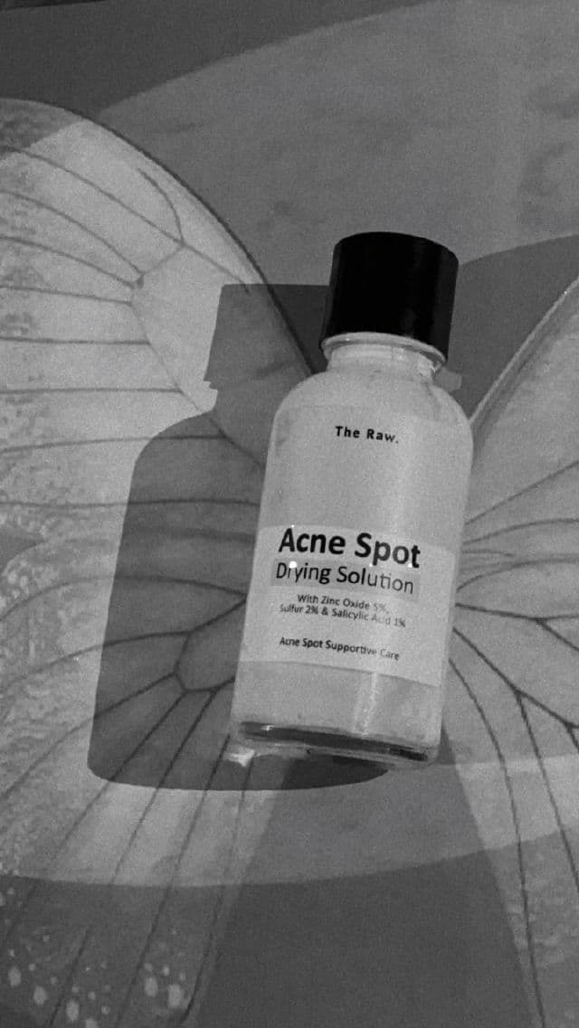 The Raw. Acne Spot Drying Solution review photo by ashareview