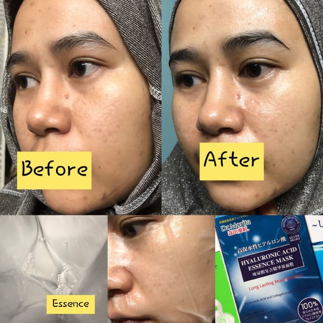 Dr. Morita HA Essence Long Lasting Facial Mask review photo by athirahlani