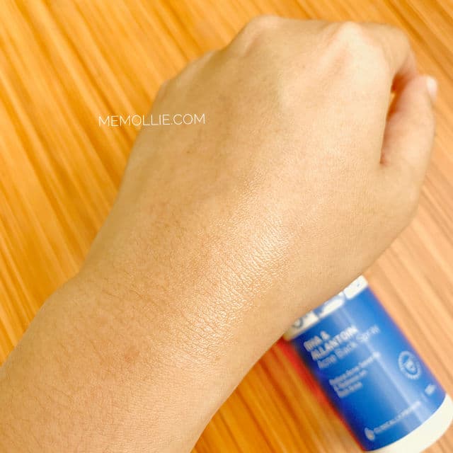 ERHA Acne Care Lab Back Spray review photo by aulawl