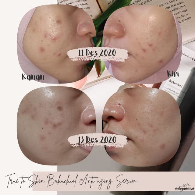 True to Skin Bakuchiol Skin Smoothing & Anti-Aging Serum review photo by auliyaaaara
