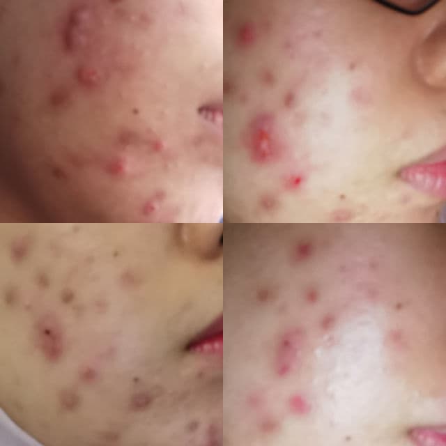 Eucerin White Therapy Gentle Cleansing Foam review photo by NurrAinn