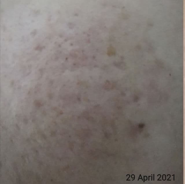 Lacoco en nature Darkspot Essence review photo by ayugotoglow