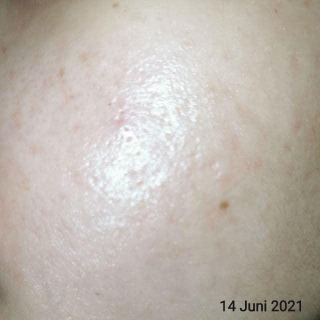 Lacoco en nature Darkspot Essence review photo by ayugotoglow