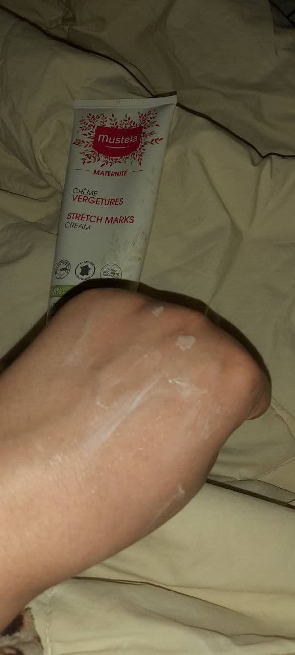 Mustela Stretch Marks Recovery Serum review photo by RODYAGHA