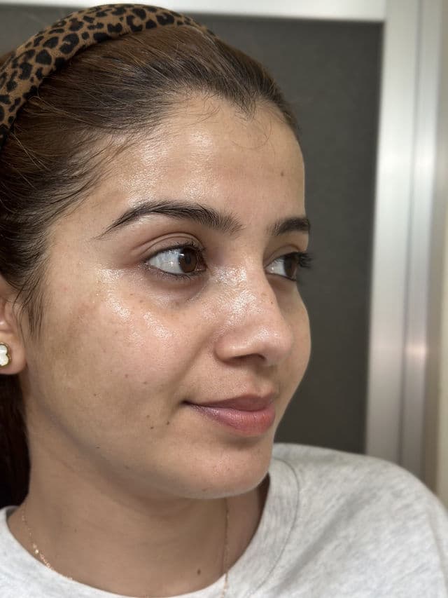 VT COSMETICS Pro Cica Reedle Shot 100 2-Step Hydrogel Mask review photo by Roshni4