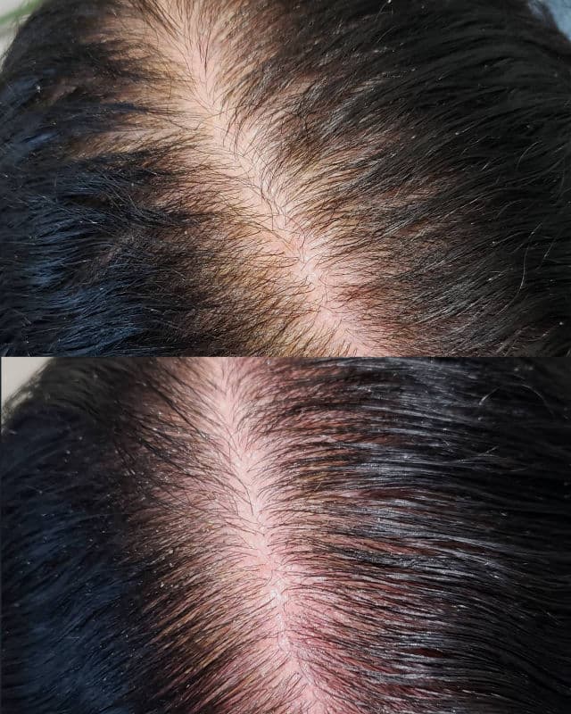 Dr.FORHAIR Folligen Original Tonic review photo by AlottaxReviews