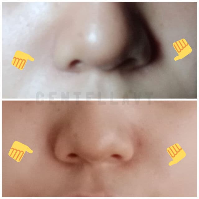 AMPLE:N Peptide Shot Ampoule review photo by datperi