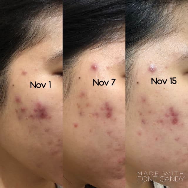 Banish Pumpkin Enzyme Mask review photo by maliaperks