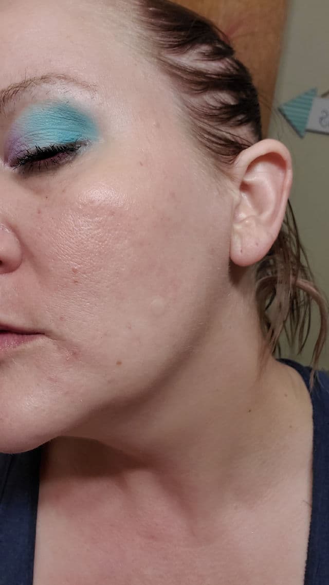 Hero Cosmetics Mighty Patch Invisible+ review photo by beautybonnebeth