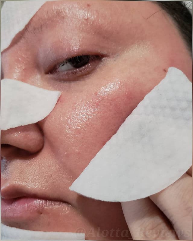 Banila Co. Clean it Zero Green Peel Toner Pad review photo by AlottaxReviews