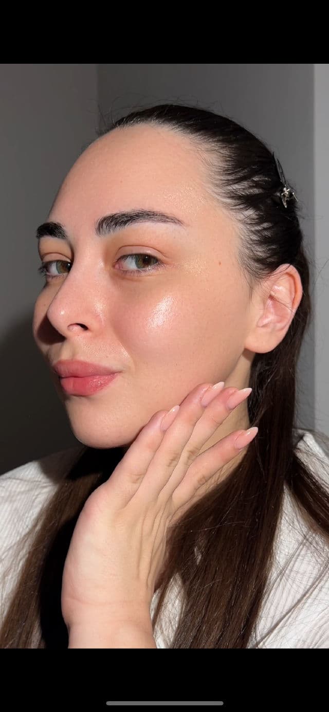 VT COSMETICS Reedle Shot 100 review photo by sonyabloomberg