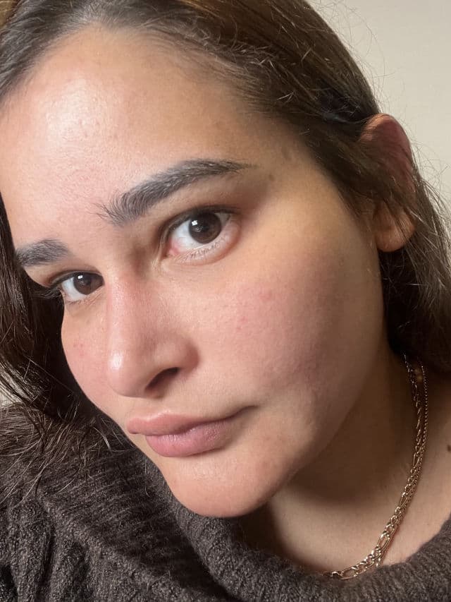 TIRTIR Azelaic Acid 12% Serum review photo by genesisrammy