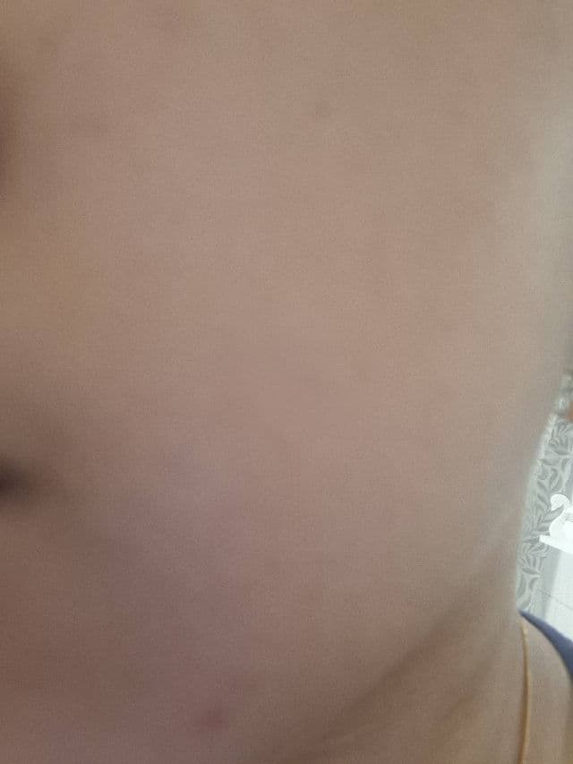 FATION Nosca 9 Trouble Cream review photo by Lalaliaa