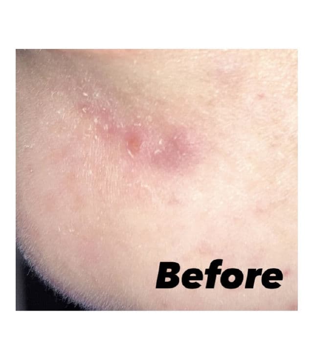 Rovectin Skin Essentials Activating Treatment Lotion review photo by Leezy