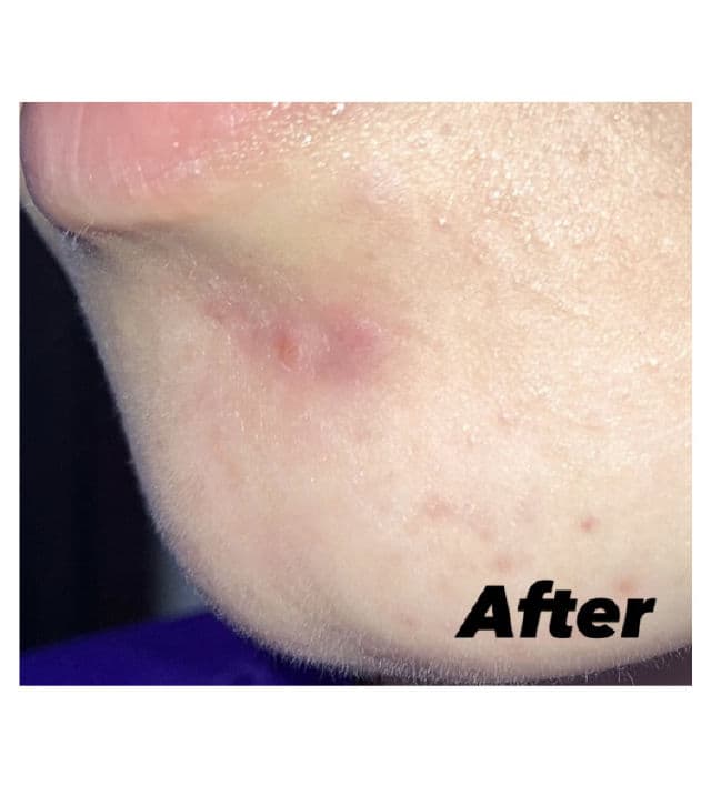 Rovectin Skin Essentials Activating Treatment Lotion review photo by Leezy